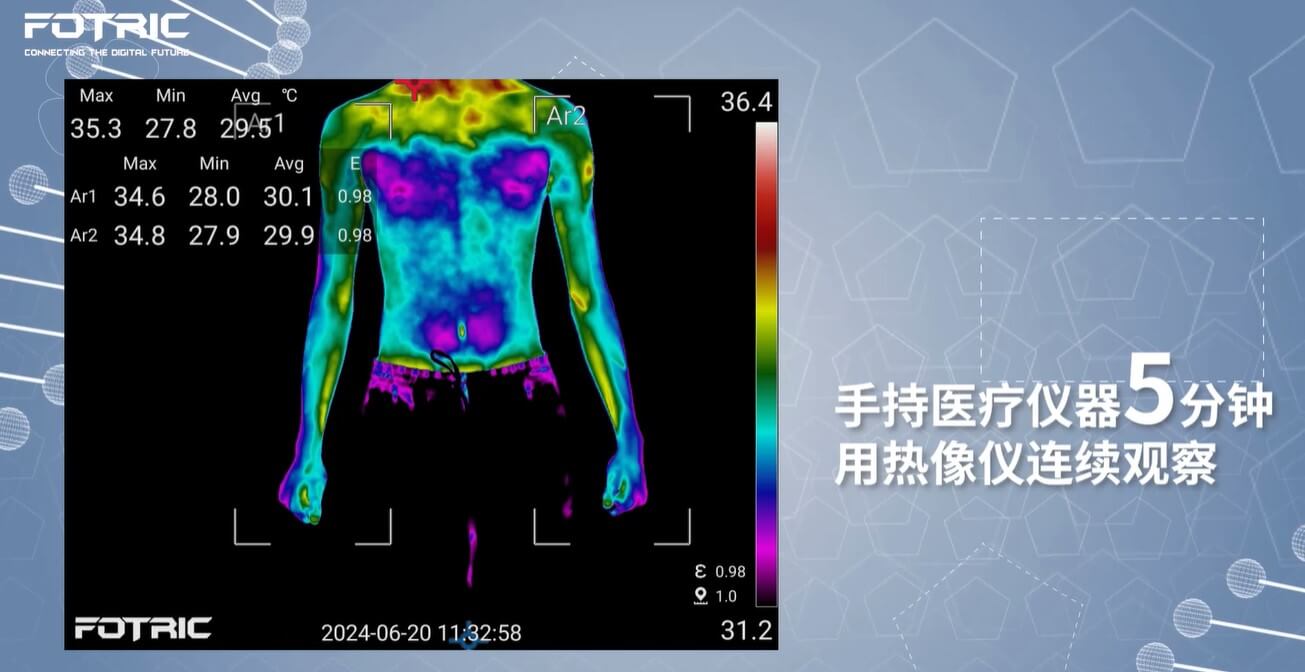 热像仪测试人体经络温度.jpg